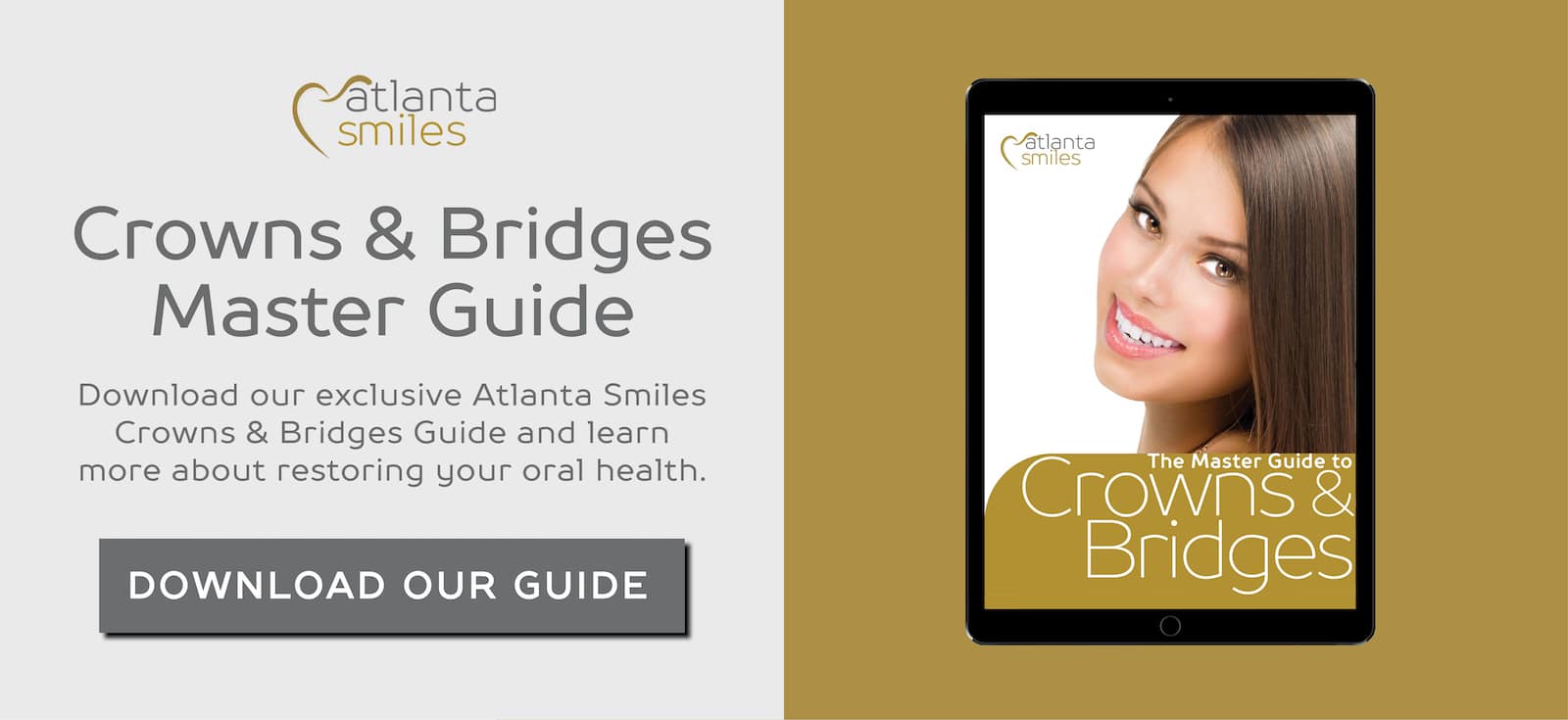 Crowns & Bridges Master Guide