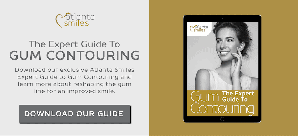 Gum Contouring Guide Atlanta Smiles